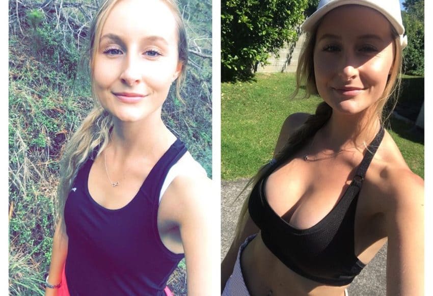 Фото до і після збільшення грудей